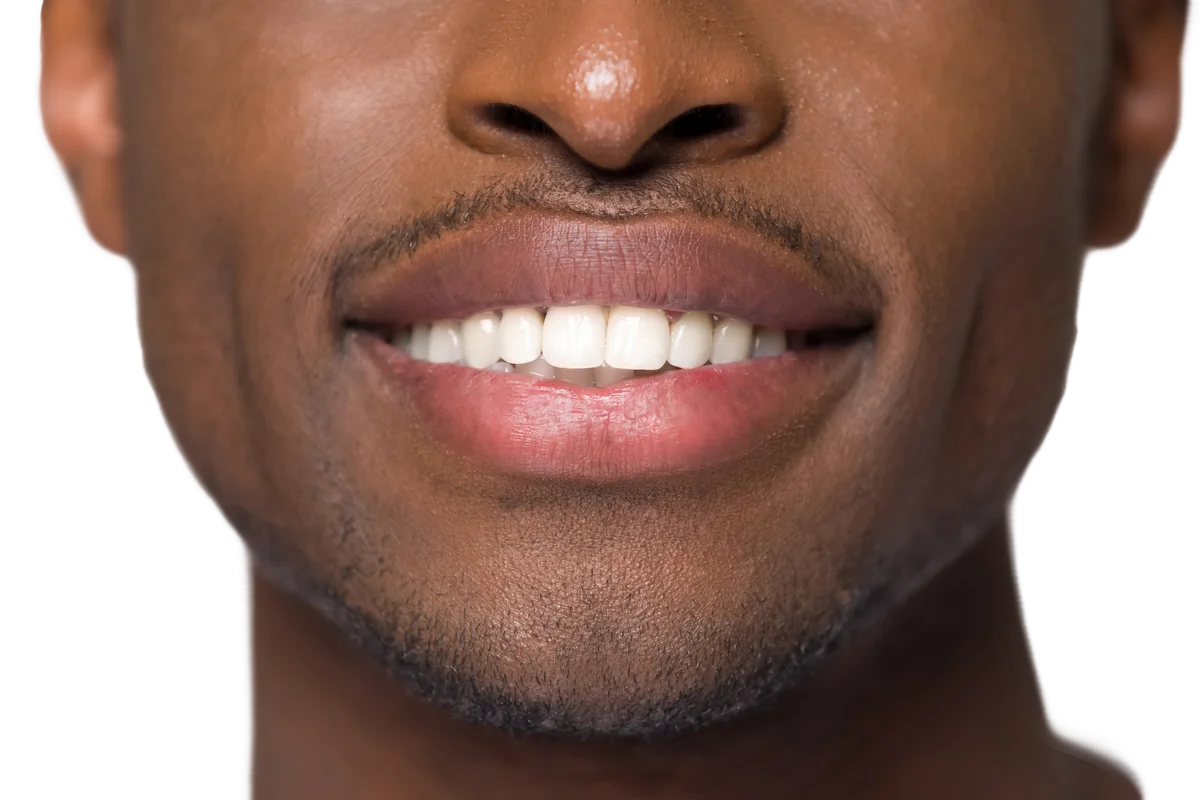 Confident smile after cosmetic treatment